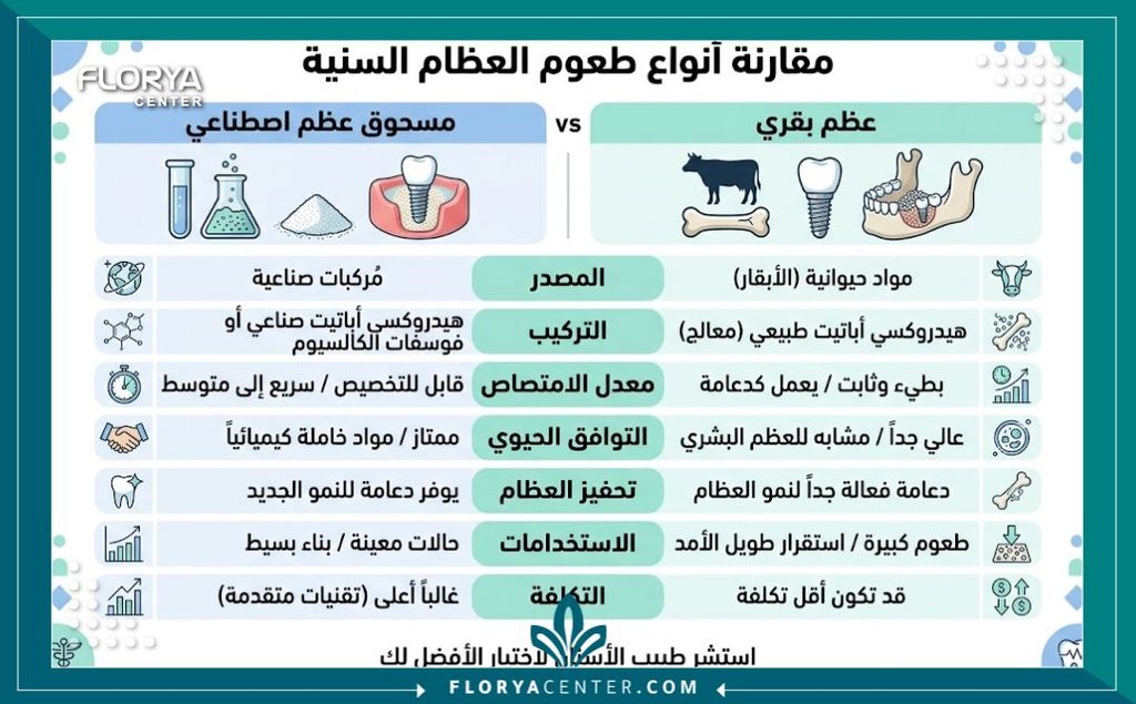 إنفوجرافيك يقارن بين أنواع الطعوم العظمية المستخدمة في زراعة الأسنان مثل العظم الصناعي والبقري.
