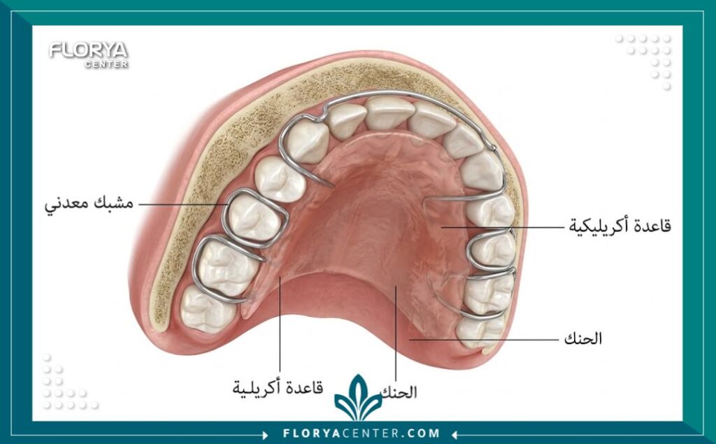 رسم توضيحي طبي دقيق يوضح تشريح الفك العلوي ومكونات التقويم المتحرك المستخدم لتوسيع الفك وتعديل العظام للأطفال.