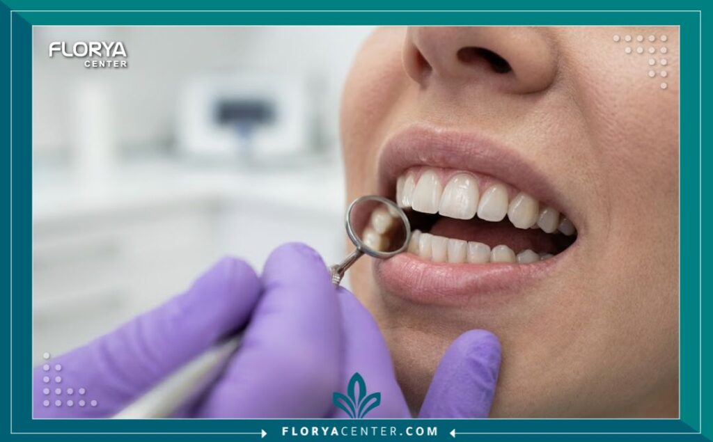 فحص ابتسامة هوليوود وتركيبات الفينير الدقيقة، جودة تجميل الأسنان في تركيا.