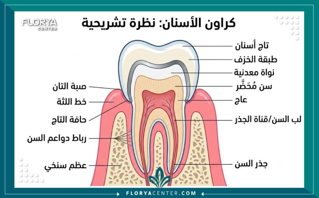 رسم طبي توضيحي يبين طريقة تركيب تاج الزيركون أو البورسلين على السن ومدى توافقه مع اللثة.