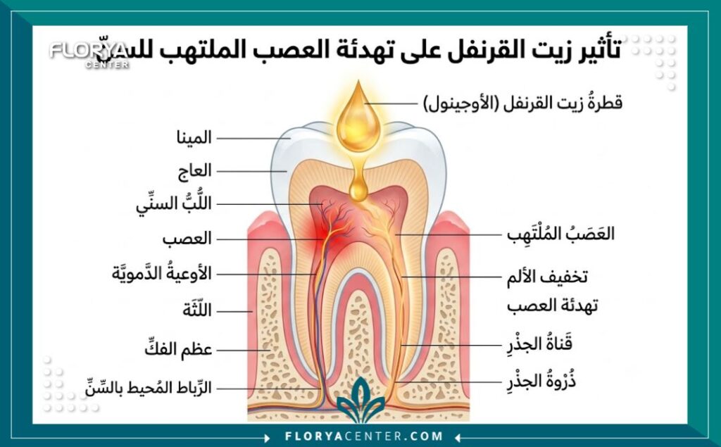 رسم توضيحي طبي يبين تشريح السن من الداخل وكيفية عمل مادة اليوجينول الموجودة في القرنفل لالم الاسنان وتخدير العصب.
