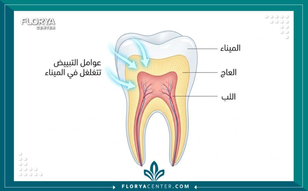 رسم توضيحي طبي لطبقات السن يشرح أسباب حساسية و ألم الأسنان بعد التبييض.