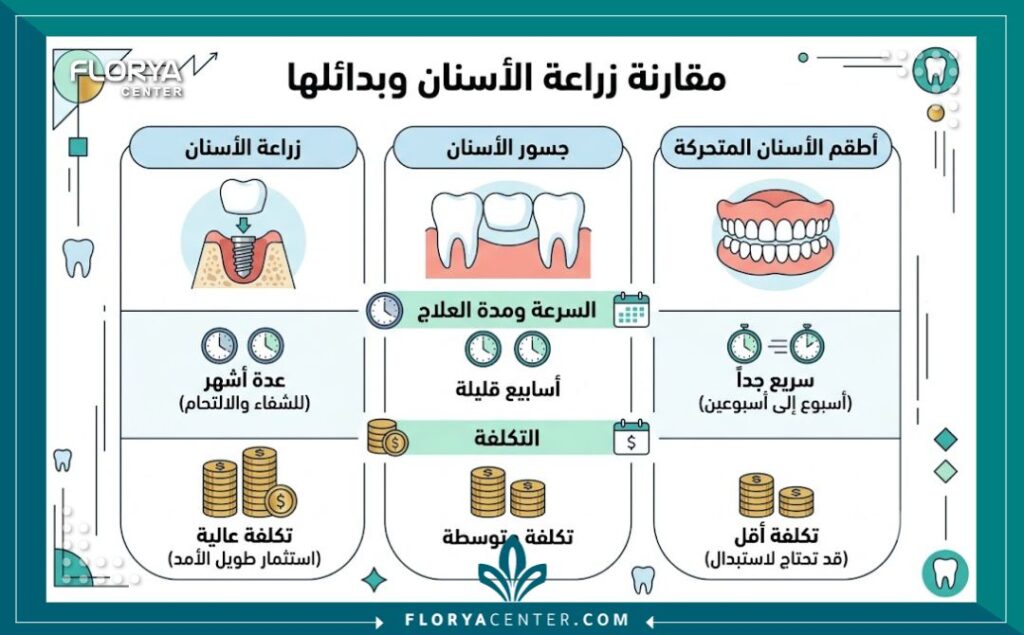 بديل زراعة الاسنان في تركيا 3 إنفوجرافيك يقارن بين تكلفة ووقت زراعة الأسنان مقابل بديل زراعة الاسنان في تركيا مثل الجسور والأطقم.