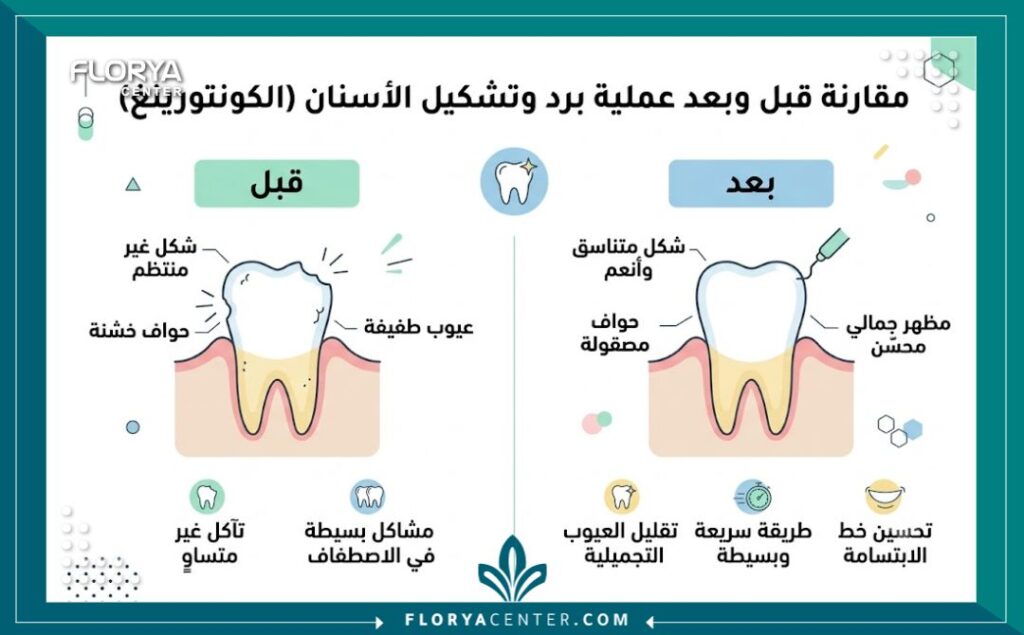 برد الاسنان في تركيا 3 إنفوجرافيك يوضح مقارنة شكل السن وحجمه قبل وبعد عملية برد الاسنان في تركيا لتجهيزها للتجميل.