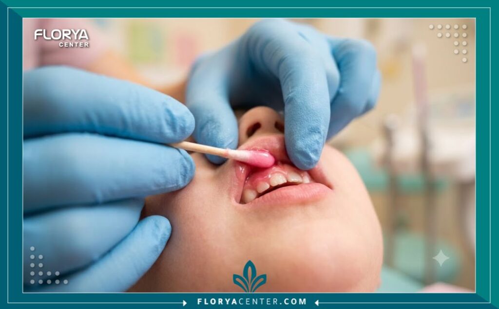 طبيب أسنان يستخدم جل التخدير بنكهة الفراولة كبديل مبدئي لتخفيف ألم إبرة بنج الاسنان للاطفال.