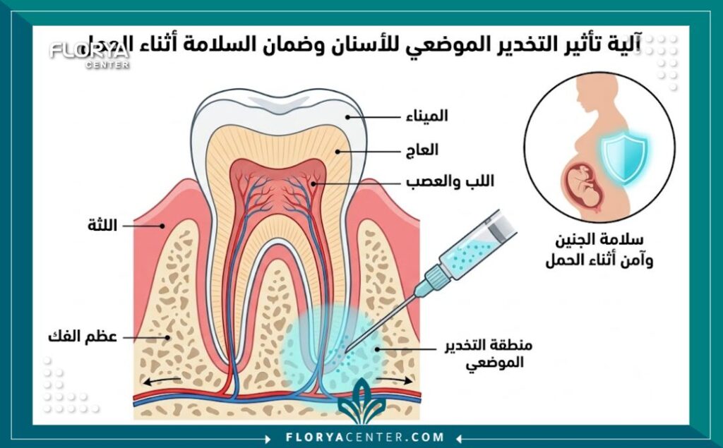 رسم توضيحي طبي يبين آلية عمل بنج الأسنان الموضعي وعدم وصوله للجنين لضمان العلاج الآمن للحامل.
