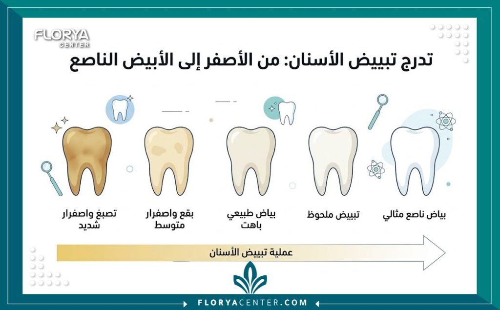 إنفوجرافيك يقارن درجات لون الأسنان قبل وبعد الخضوع لعملية تبييض الاسنان بالبلازما للحصول على ابتسامة ناصعة.
