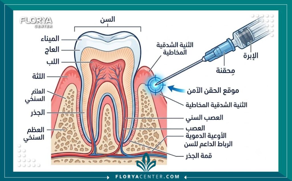رسم توضيحي طبي لتشريح السن يوضح كيفية عمل تخدير الأسنان الموضعي ومكان حقن إبرة البنج العادية بأمان.
