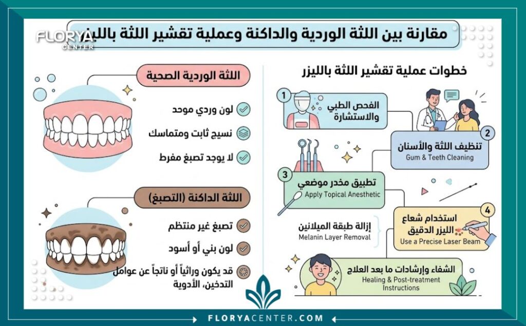 إنفوجرافيك يوضح الفرق بين اللثة الداكنة واللثة الوردية وخطوات العلاج بالليزر