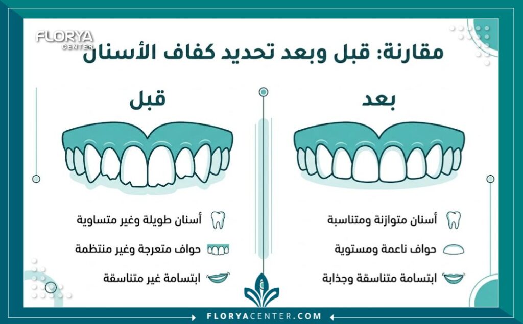 تصغير الاسنان في تركيا 3 إنفوجرافيك يوضح الفرق بين شكل الأسنان قبل وبعد عملية تصغير وبرد الأسنان الأمامية.
