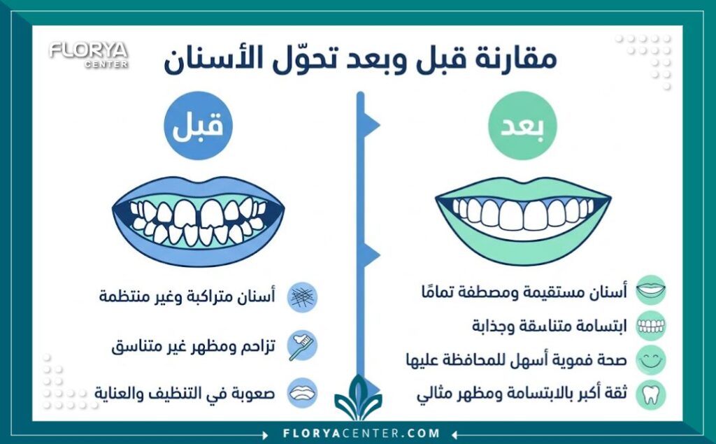 تعديل شكل الاسنان في تركيا 3 إنفوجرافيك يقارن بين شكل الأسنان قبل وبعد إجراء برد وتعديل الأسنان التجميلي.