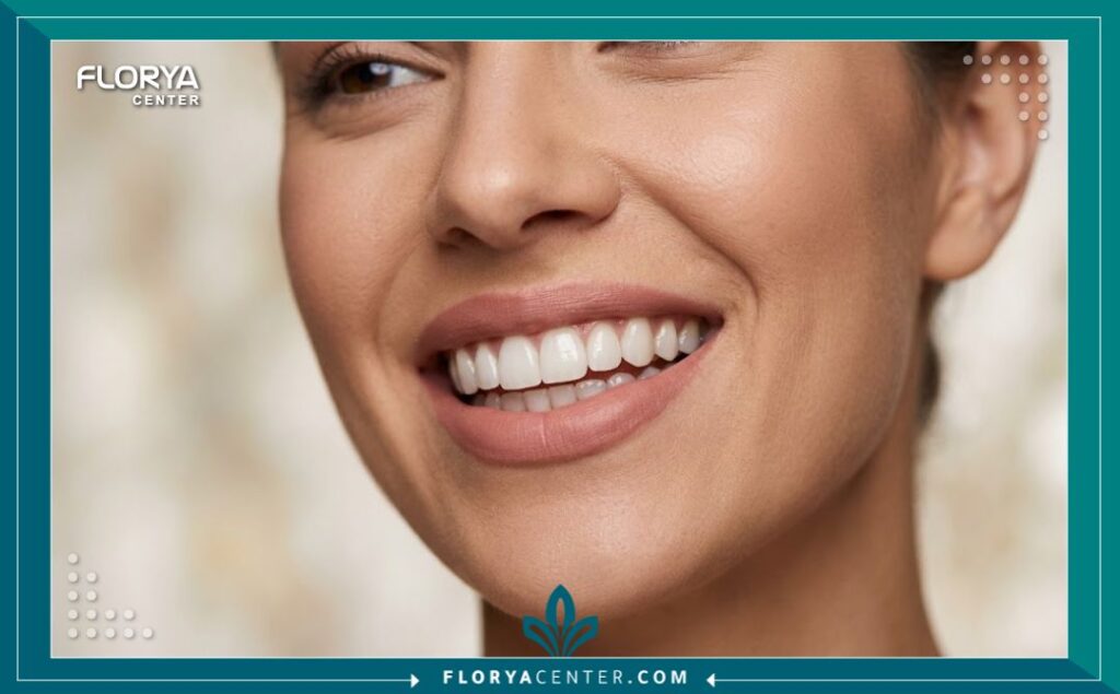 ابتسامة ناصعة البياض بعد الحصول على فينير أسنان بتكلفة تجميل الاسنان في تركيا.