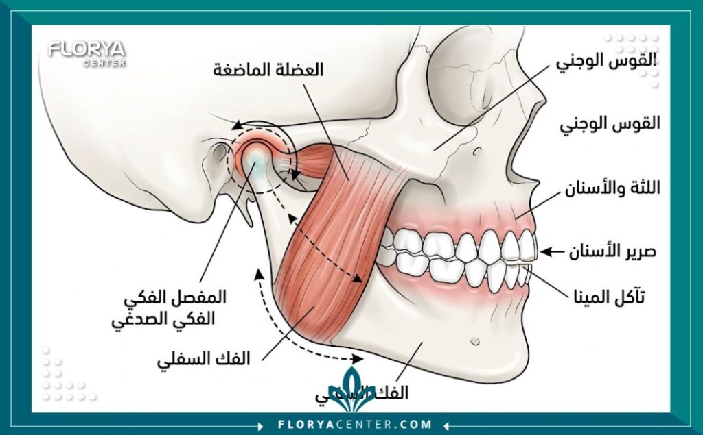 مخطط تشريحي يوضح عضلة الفك والمفصل الصدغي الفكي لبيان أسباب و تكلفة علاج صرير الأسنان.