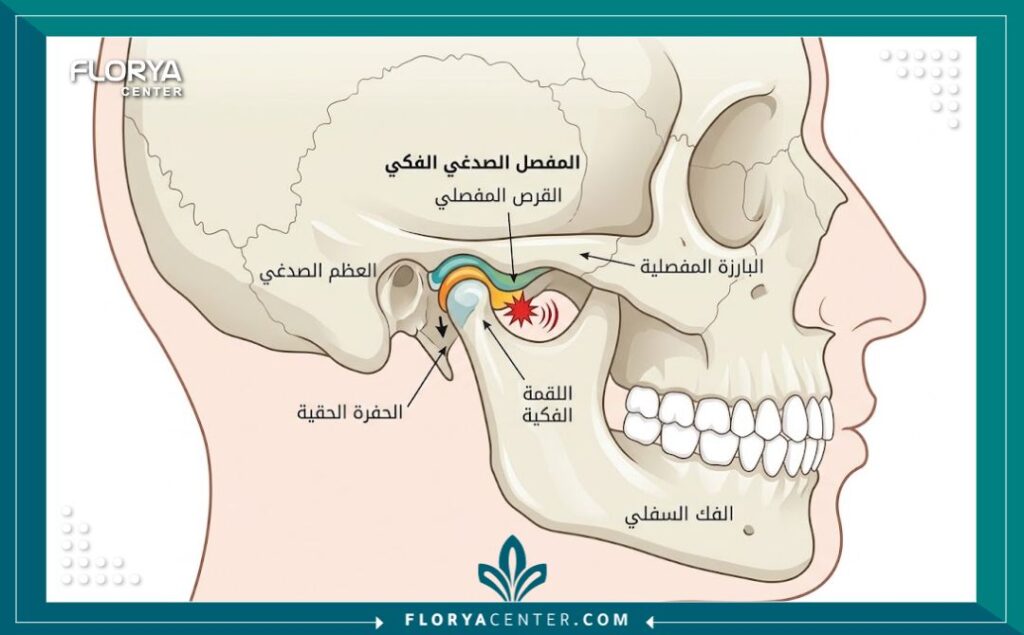 رسم تخطيطي تشريحي لمفصل الفك يوضح أسباب طقطقة الفك واضطراب المفصل الصدغي TMJ