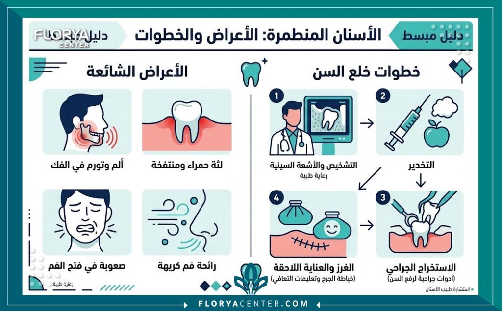 إنفوجرافيك موضح لأعراض الأضراس والأنياب المطمورة ومخاطر إهمال جراحة الأسنان المدفونة