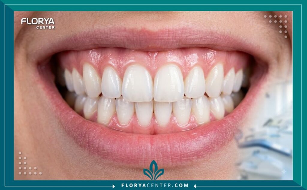 حجز موعد طبيب اسنان واتساب 5 ابتسامة هوليوود ناصعة البياض وأسنان مثالية يمكنك الحصول عليها عبر حجز موعد طبيب اسنان واتساب.