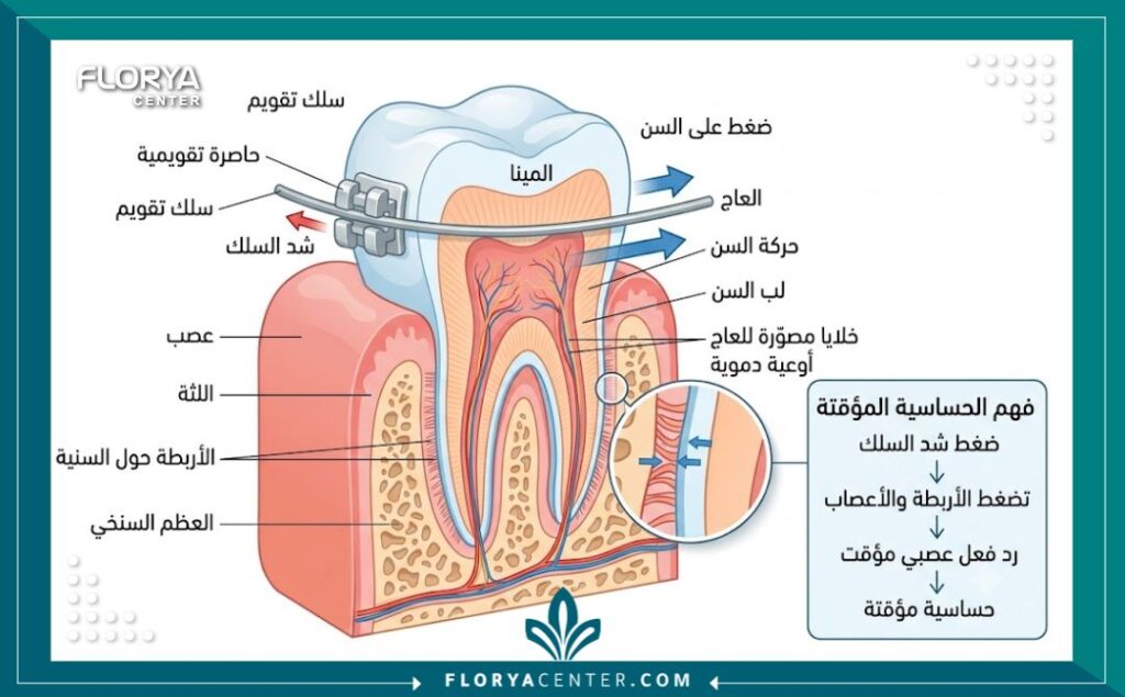 حساسية الاسنان بعد التقويم 2 رسم توضيحي طبي يوضح التركيب الداخلي للسن وتأثير الشد على العصب الذي يسبب حساسية الأسنان المؤقتة.