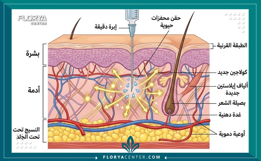 رسم توضيحي طبي لطبقات الجلد يوضح آلية عمل إبر محفزات الكولاجين مثل سكولبترا في بناء الكولاجين وشد الترهلات.