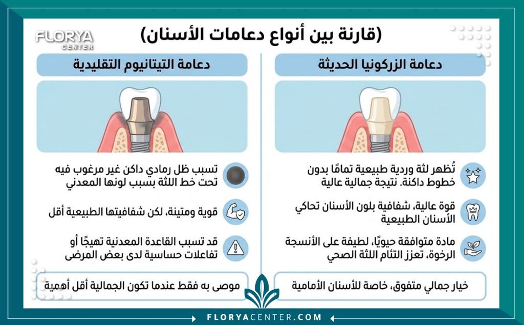 دعامات الزركون لزراعة الاسنان في تركيا 3 إنفوجرافيك يقارن بين دعامات الزركون لزراعة الاسنان والدعامات المعدنية (التيتانيوم) في زراعة الأسنان، يبرز تفوق الزركون في تجميل اللثة.