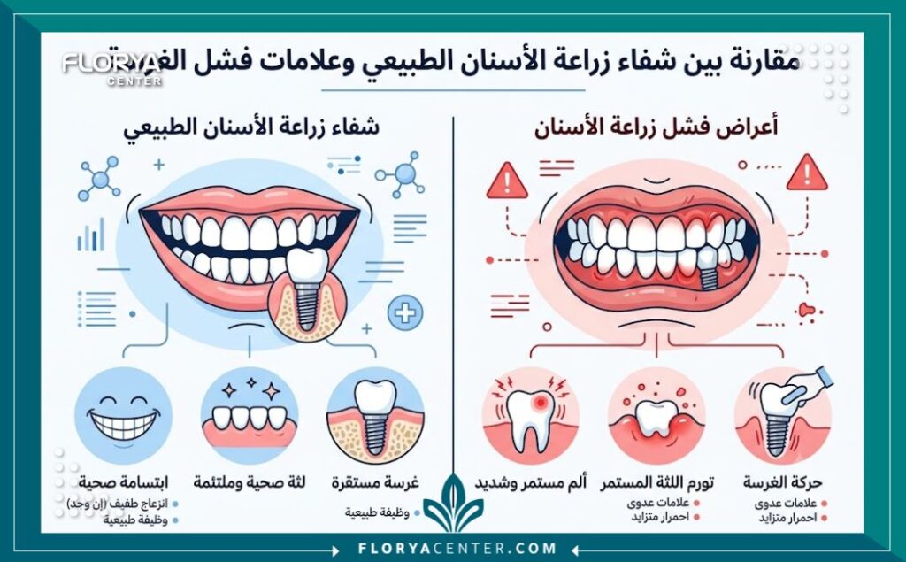 إنفوجرافيك طبي يقارن بين الشفاء الطبيعي وعلامات فشل زراعة الأسنان مثل الألم المستمر، التورم، وحركة الزرعة.