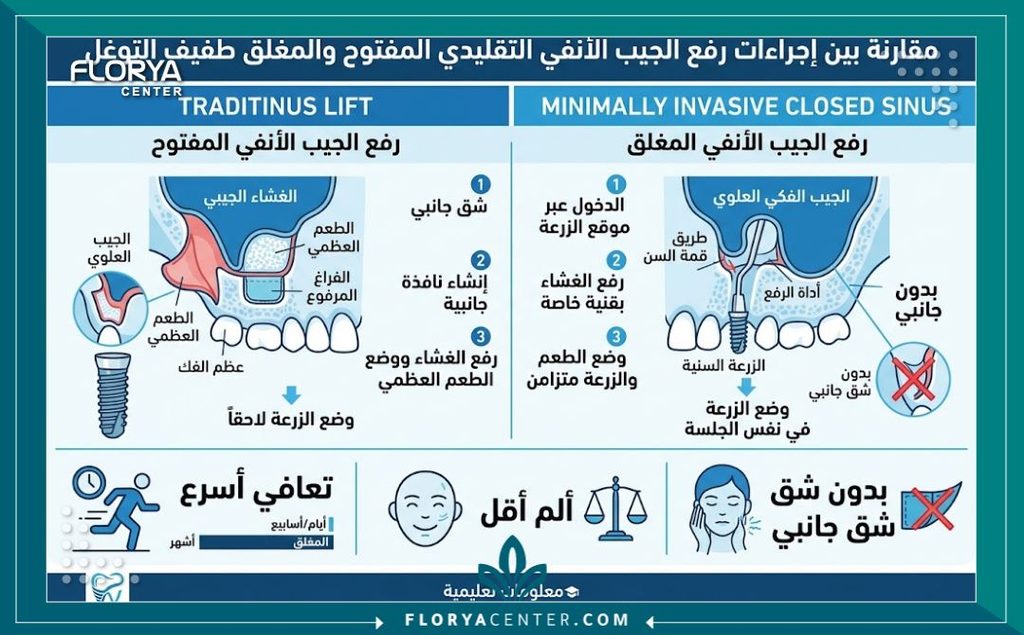 إنفوجرافيك يقارن بين تقنية رفع الجيب الفكي المفتوح والمغلق، يوضح مميزات الطريقة الأقل توغلاً وسرعة التعافي.