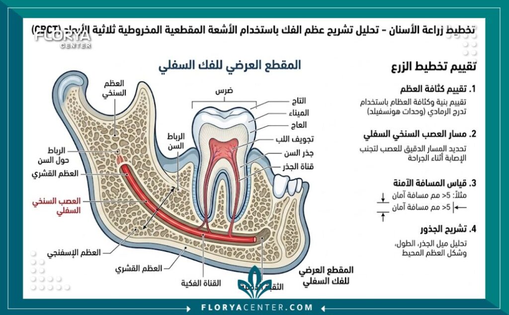 سعر اشعة 3D للاسنان في تركيا 2 رسم تخطيطي توضيحي لأهمية الأشعة المقطعية ثلاثية الأبعاد CBCT للفكين لتخطيط زراعة الأسنان
