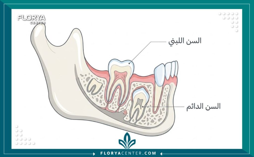 رسم توضيحي طبي يبين تشريح السن اللبني للأطفال والسن الدائم الجذور تحته لمعرفة دواعي خلع الأسنان اللبنية المتهالكة.