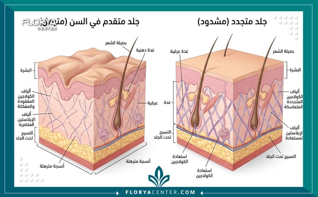 رسم توضيحي طبي يوضح تشريح طبقات الجلد وكيفية عمل شد الترهلات وتحفيز الكولاجين للمرضى فوق سن الخمسين.