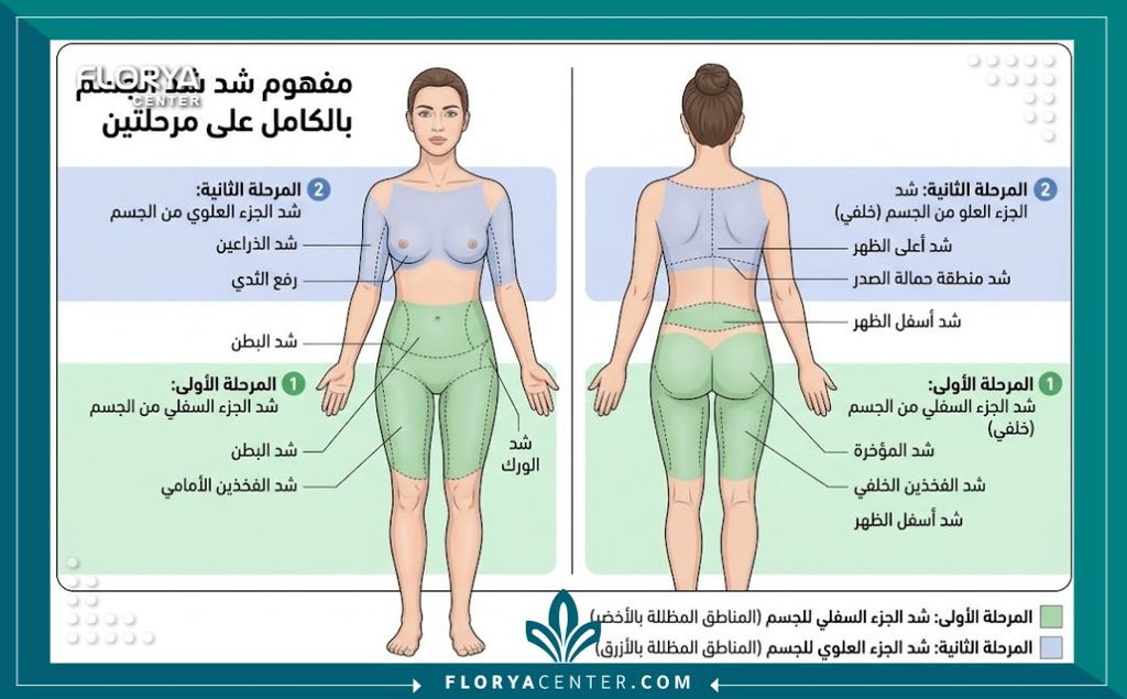 رسم توضيحي طبي يشرح تقسيم مناطق جراحة شد الجسم الكلي على مرحلتين للجزء العلوي والسفلي لضمان الأمان.