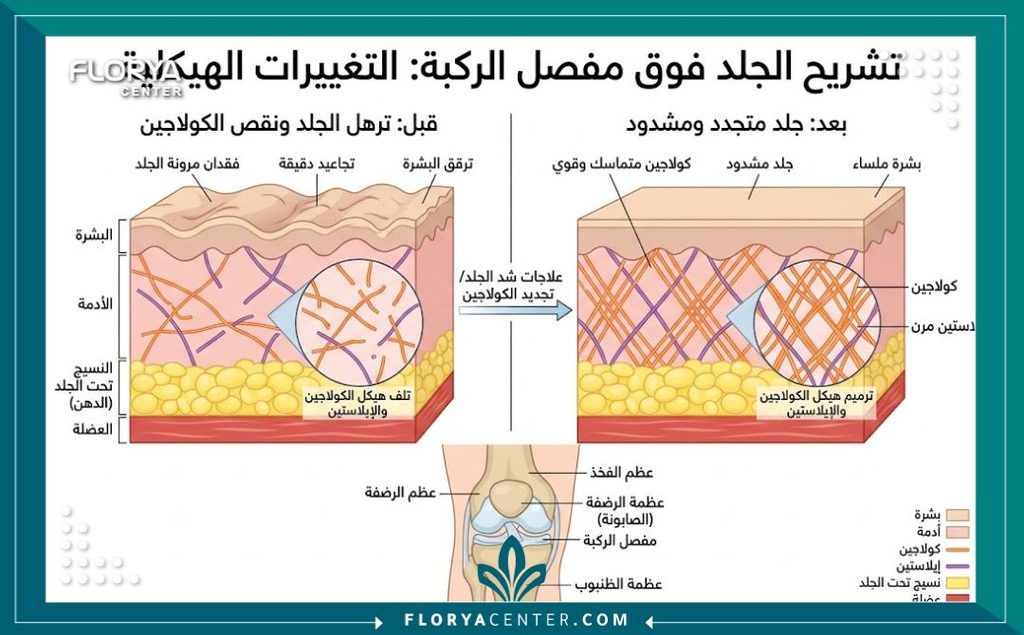شد الركبتين المترهلة 2 رسم توضيحي طبي لطبقات الجلد يوضح أسباب ترهل الركبتين وفقدان الكولاجين المسبب للجلد المجعد.