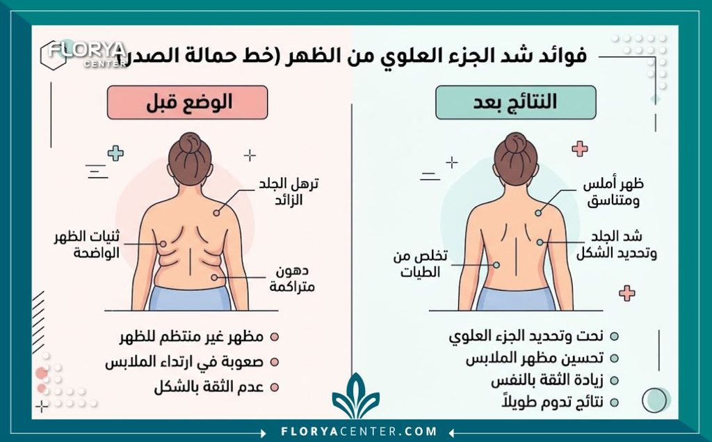 إنفوجرافيك يقارن بين ترهلات أعلى الظهر والنتائج المثالية لعملية شد خط حمالة الصدر.