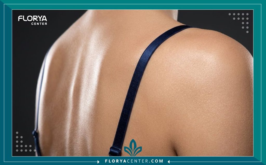 لقطة مقربة تبرز النتيجة التجميلية الدقيقة لعملية شد خط حمالة الصدر ونعومة الجلد الفائقة.