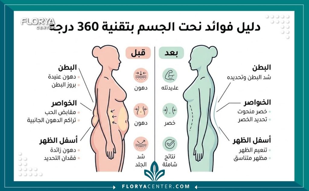شد محيط الخصر والظهر 3 إنفوجرافيك يقارن بين شكل الجسم قبل وبعد جراحة شد الحزام الدائري 360 للتخلص من الترهلات.