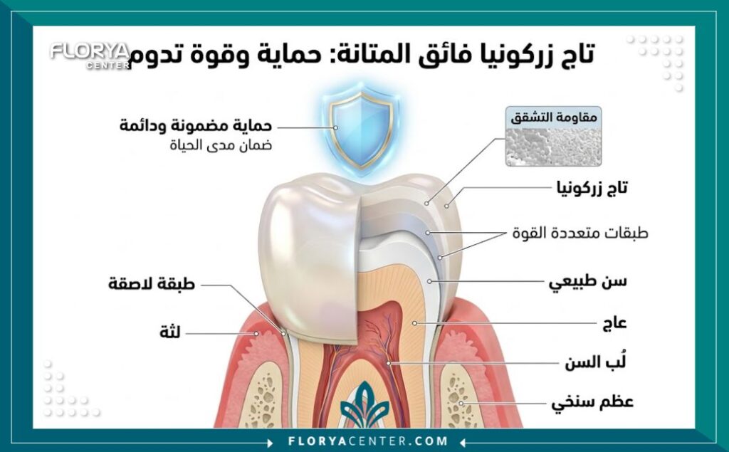 رسم توضيحي طبي يبرز قوة طبقات تركيبات الزيركون ومقاومتها العالية للتكسر بمرور الوقت.