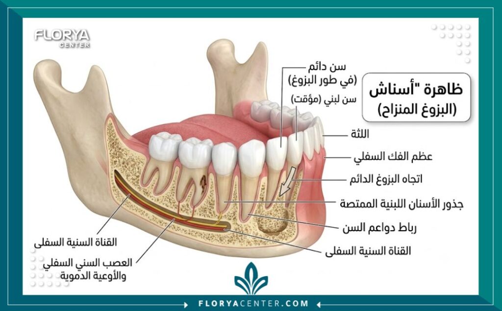 رسم تشريحي طبي يوضح كيفية بزوغ السن الدائم خلف السن اللبني في الفك السفلي.