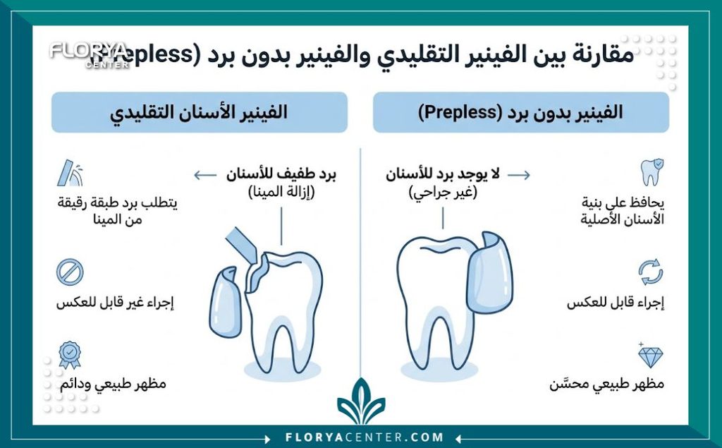 عدسات الفينير بدون برد في تركيا 3 إنفوجرافيك يوضح الفرق بين الفينير التقليدي وعدسات الفينير بدون برد ومميزات تقنية اللومينير في تجميل الأسنان.
