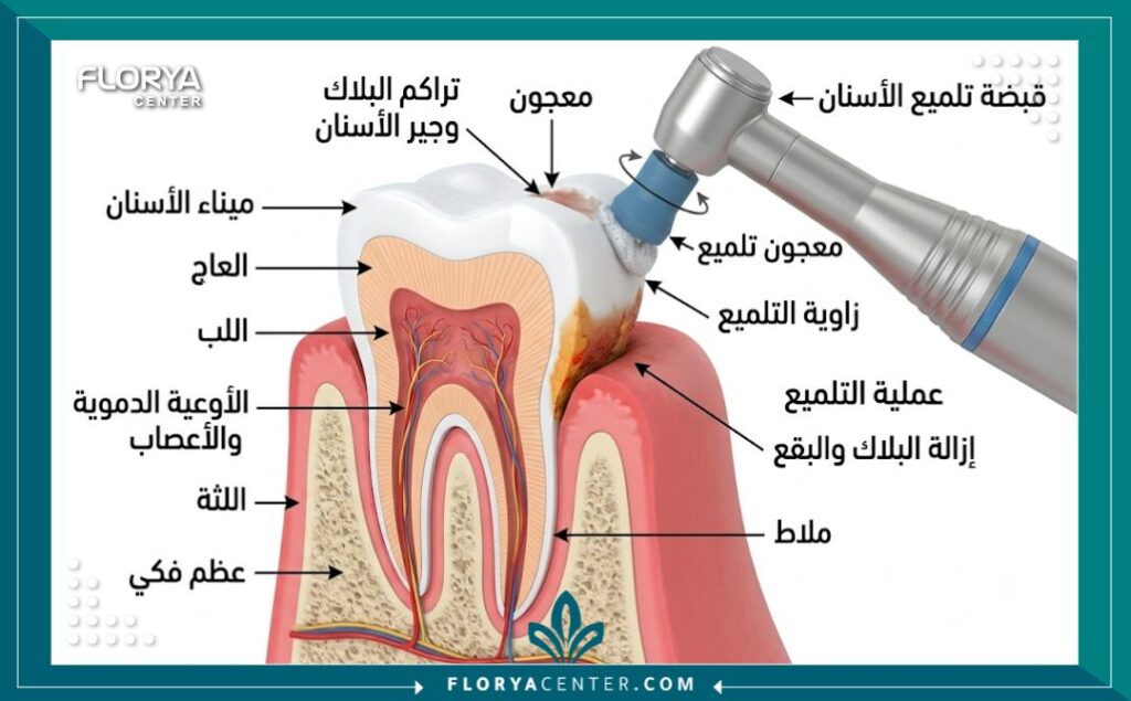 رسم توضيحي طبي لطبقات السن يوضح كيفية عمل أجهزة تلميع الأسنان وإزالة الجير السطحي.