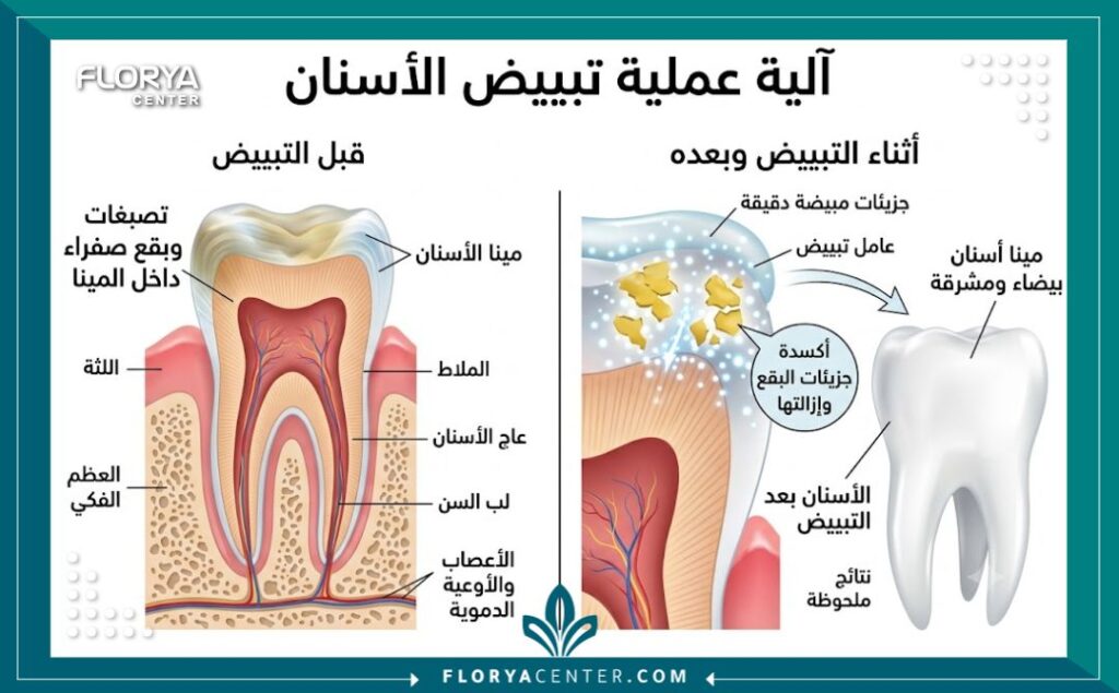 رسم توضيحي طبي لطبقات السن يوضح كيفية عمل مواد تبييض الأسنان في إزالة التصبغات العميقة.