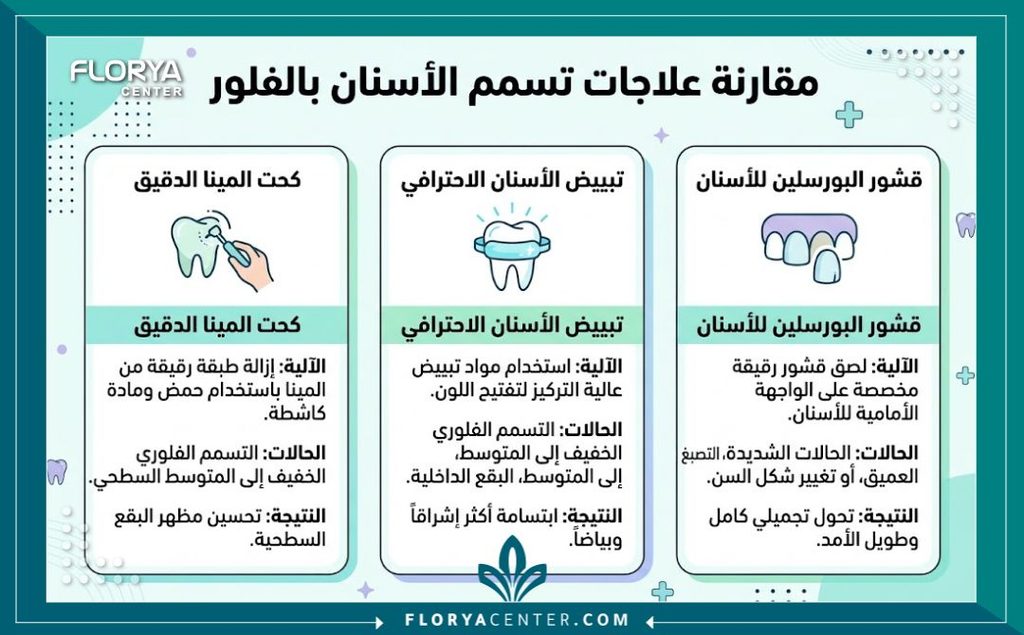 إنفوجرافيك طبي يوضح مقارنة بين الخيارات المختلفة لعلاج الفلورة السنية مثل الكشط الدقيق للمينا والفينير.