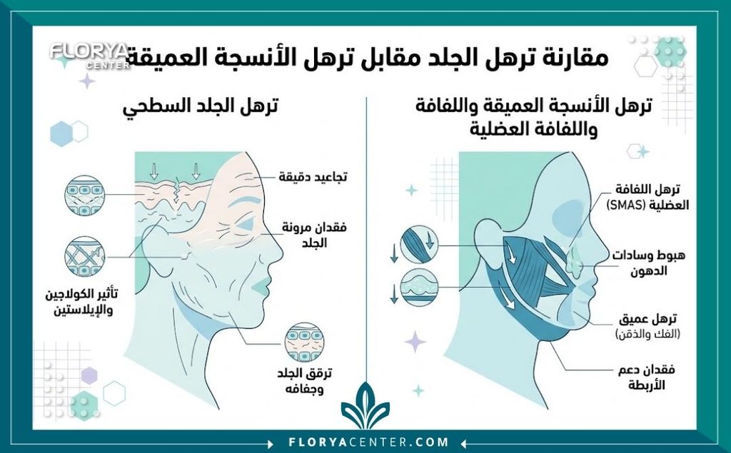 علاج ترهل الأنسجة العميقة 3 إنفوجرافيك يقارن بين الترهل السطحي للجلد وترهل الأنسجة العميقة واللفافة العضلية.