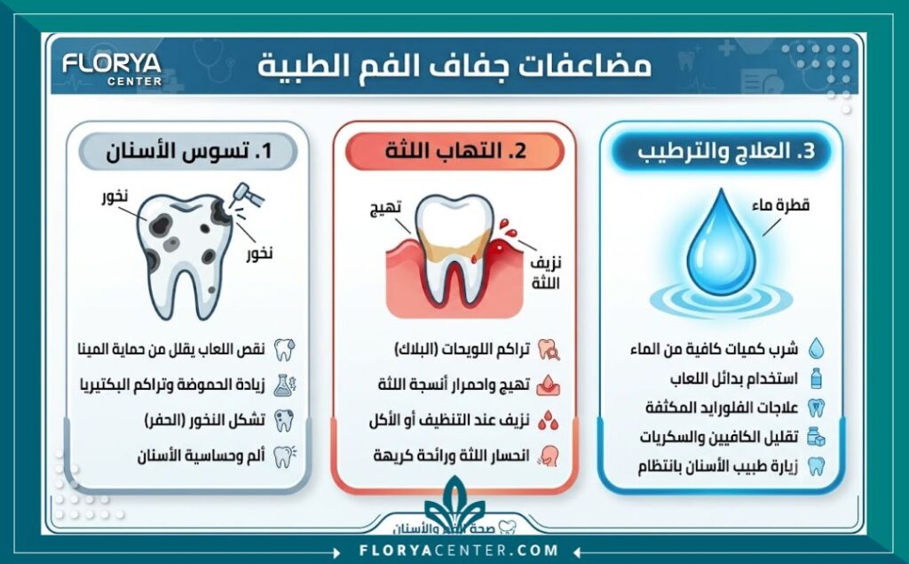 علاج جفاف الفم في تركيا 3 إنفوجرافيك يوضح مضاعفات جفاف الفم مثل زيادة معدل تسوس الأسنان والتهاب اللثة وطرق العلاج.
