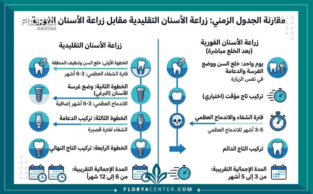 إنفوجرافيك يقارن بين زراعة الأسنان التقليدية والزراعة الفورية لتوضيح اختصار وقت العلاج لعدة أشهر.