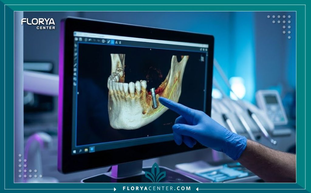 تقييم عظام الفك وتخطيط مكان الزرعة الفورية باستخدام تقنيات التصوير ثلاثي الأبعاد الحديثة.