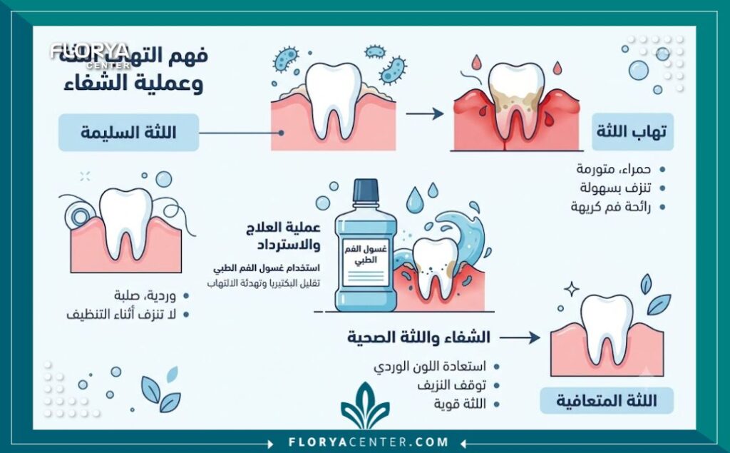 غسول الفم الطبي 3 إنفوجرافيك يوضح الفرق بين اللثة السليمة والملتهبة قبل وبعد استخدام غسول الفم الطبي.
