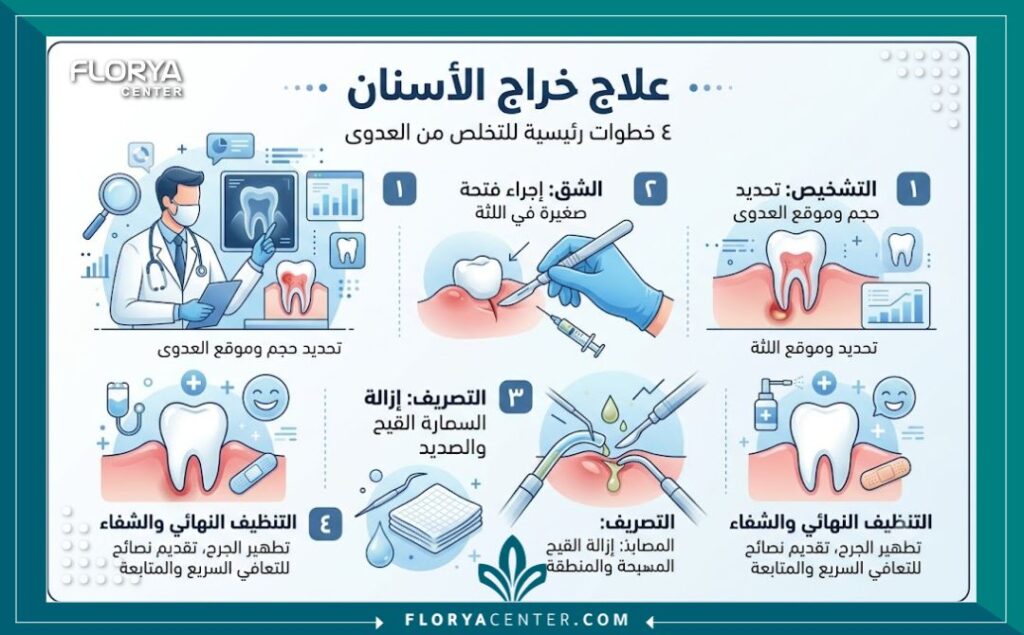 إنفوجرافيك يشرح خطوات التدخل الجراحي الطارئ لتصريف صديد خراج الأسنان وفتح الخراج وتنظيفه في تركيا.