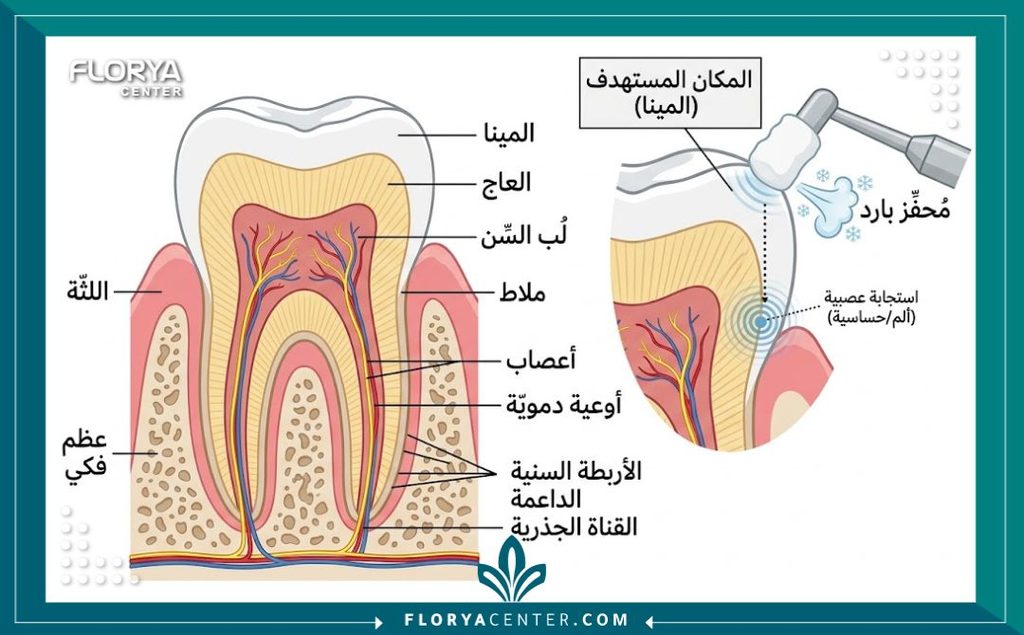 فحص حيوية اللب السني في تركيا 2 رسم تشريحي يوضح بنية السن الداخلي وعصب السن أثناء إجراء اختبار حيوية اللب بالبرودة لمعرفة حالة العصب.