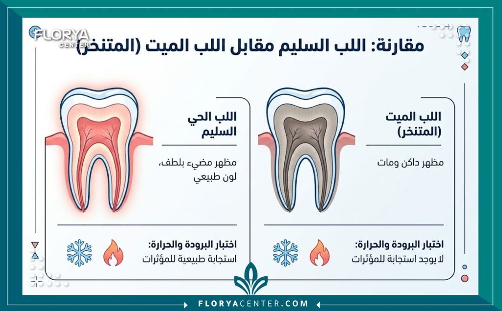 فحص حيوية اللب السني في تركيا 3 إنفوجرافيك طبي يقارن بين استجابة عصب السن الحي والميت لاختبارات الحرارة والبرودة لتقرير سحب العصب.