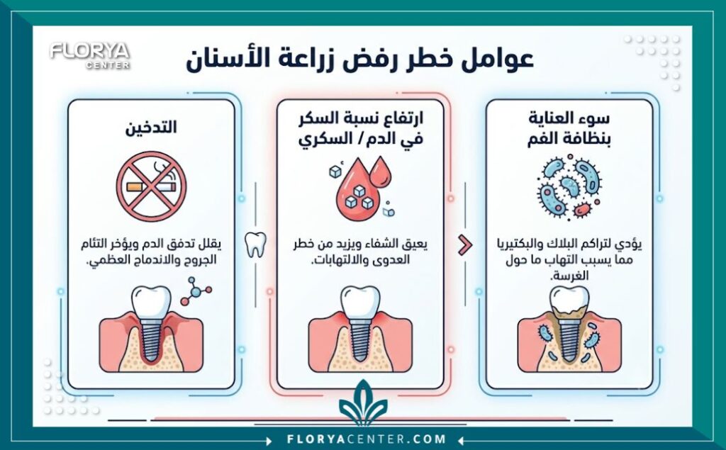 فشل زراعة الاسنان 3 إنفوجرافيك يوضح أسباب رفض الجسم لزراعة الأسنان وأبرز عوامل الخطر وفشل زراعة الاسنان مثل التدخين، مرض السكري، وسوء التعقيم.