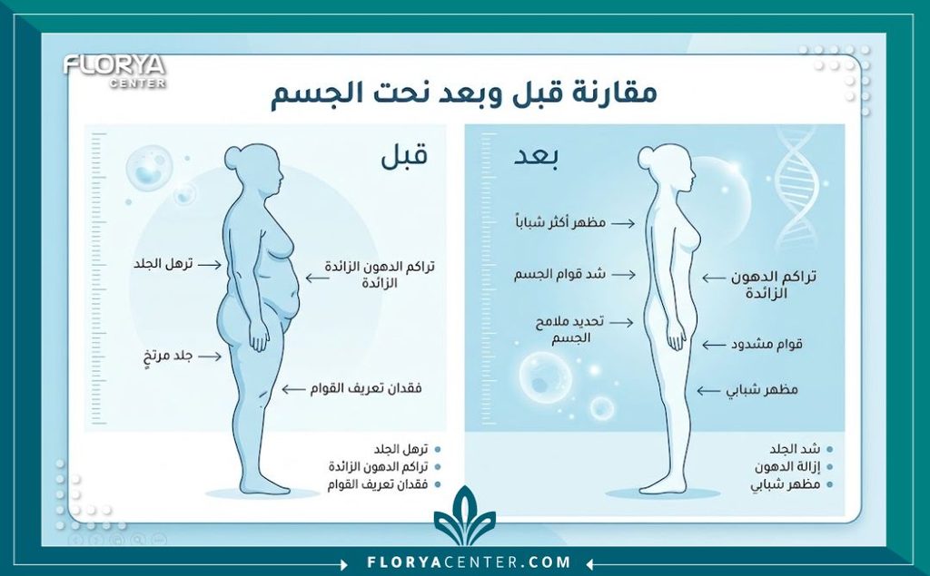 قص الجلد المترهل بعد الرجيم 3 إنفوجرافيك يقارن بين شكل الجسم قبل وبعد الخضوع لعملية قص الجلد المترهل بعد الرجيم الشديد.