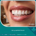 صورة مقربة تبرز جمال ابتسامة المشاهير في تركيا بأسنان ناصعة البياض وتناسق مثالي يعكس الفخامة.